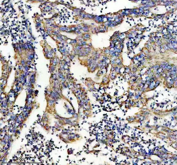 a09062 1 lrrc26 primary antibodies ihc testing 2