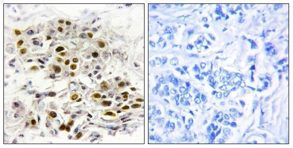 a09063 map3k6 primary antibodies ihc testing 1
