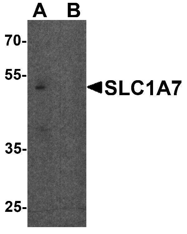 Western blot analysis of SLC1A7 in C2C12 cell lysate with SLC1A7 antibody at 1 μg/ml in (A) the absence and (B) the presence of blocking peptide