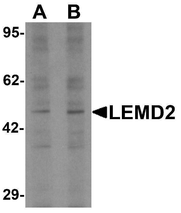 a09079 lemd2 primary antibodies wb testing 1