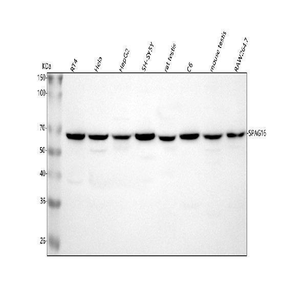  Western blot analysis of SPAG16 using anti-SPAG16 antibody (A09080-3)