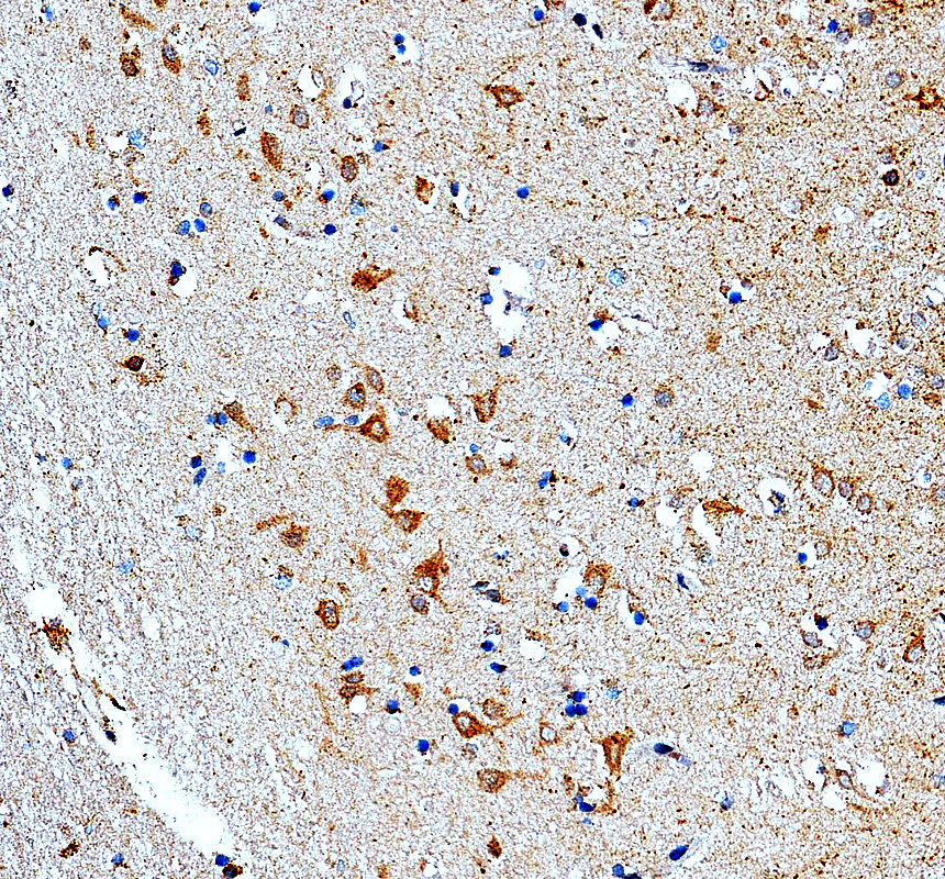 a09081 1 lrrc7 primary antibodies ihc testing 1