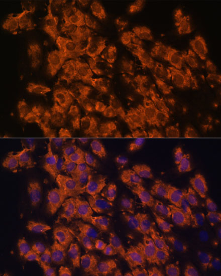 a09081 lrrc7 primary antiboties if testing 2
