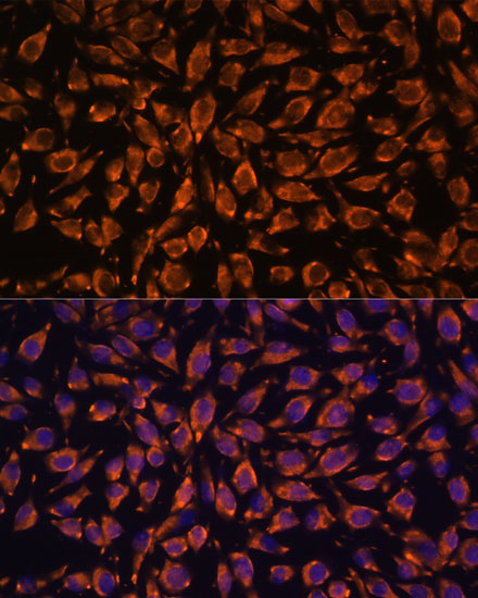 a09081 lrrc7 primary antiboties if testing 3
