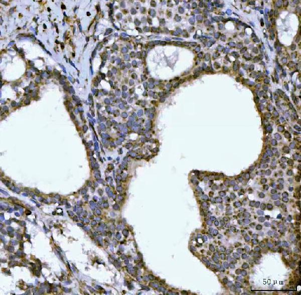 a09082 2 ndufs6 primary antibodies ihc testing 3