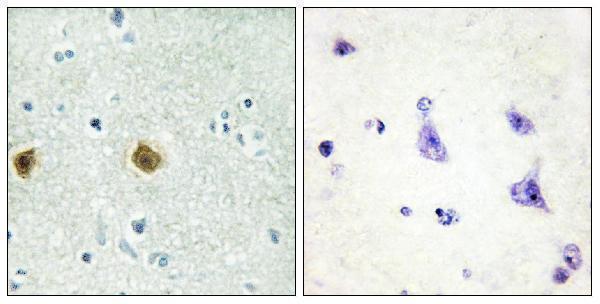 a09084 ndufc2 primary antibodies ihc testing 1