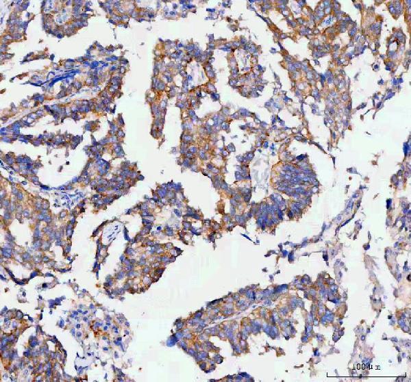  IHC analysis of RAB3IP using anti-RAB3IP antibody (A09085-3)