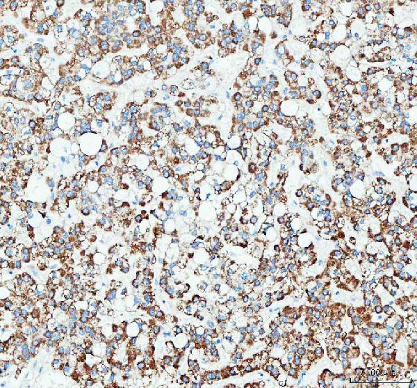  IHC analysis of RAB3IP using anti-RAB3IP antibody (A09085-3)