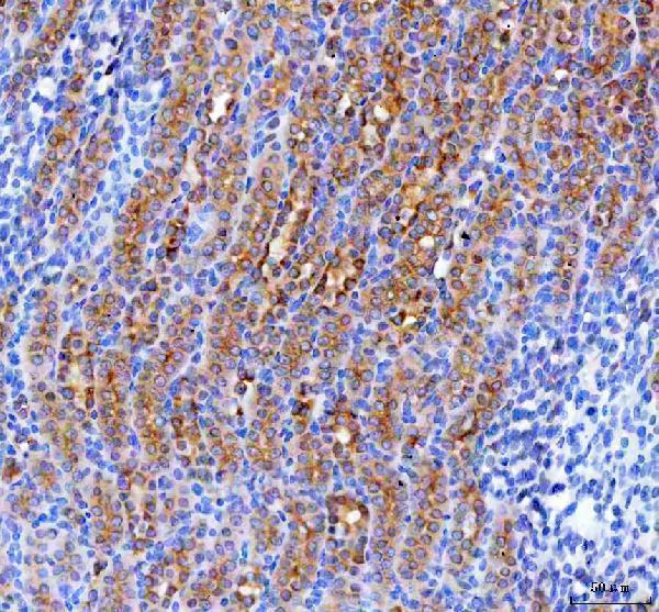 a09085 3 rab3ip primary antibodies ihc testing 4