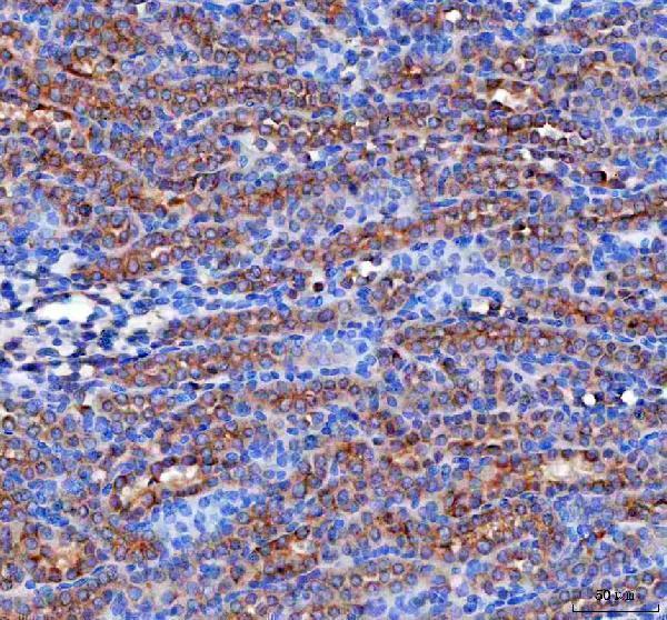 a09085 3 rab3ip primary antibodies ihc testing 5