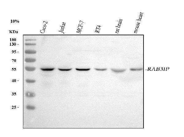  Western blot analysis of RAB3IP using anti-RAB3IP antibody (A09085-3)