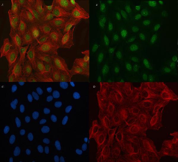 a09089 1 tnrc6c primary antibodies if testing 2