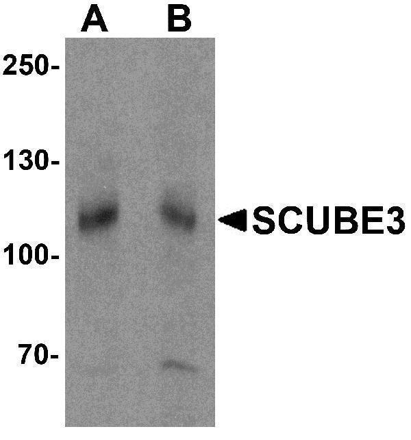 Western blot analysis of SCUBE3 in mouse kidney tissue lysate with SCUBE3 antibody at (A) 1 and (B) 2 μg/mL