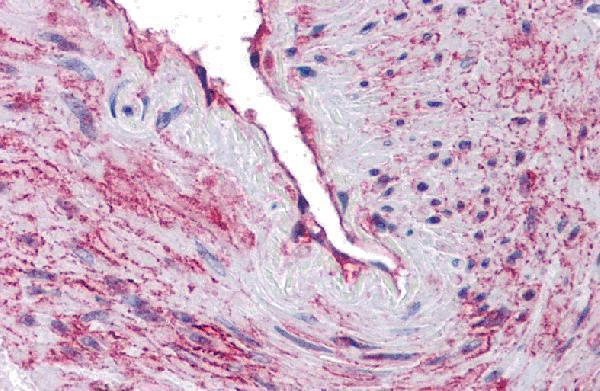 Immunohistochemistry of SCUBE3 in human blood vessel tissue with SCUBE3 antibody at 10 μg/mL