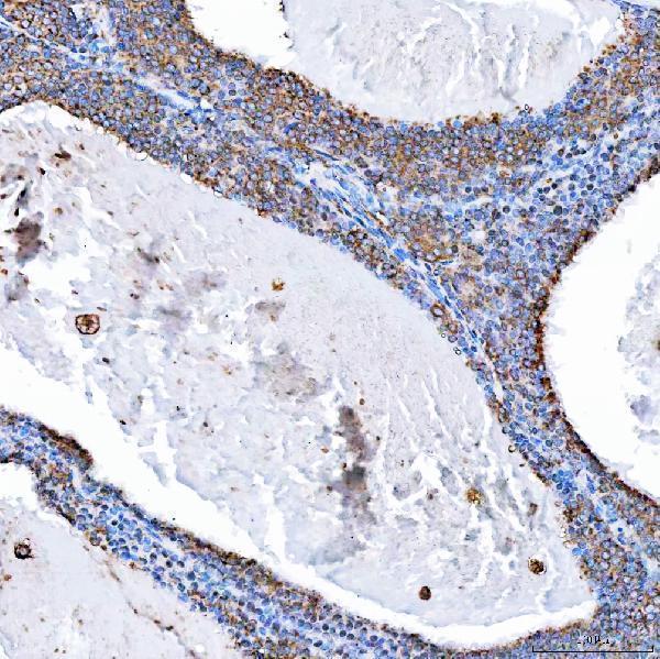 IHC analysis of SH2D4A using anti-SH2D4A antibody (A09094-2)