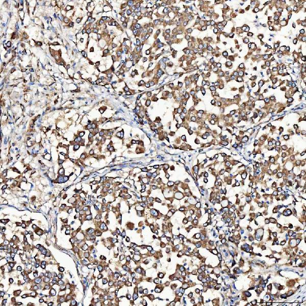 a09094 2 sh2d4a primary antibodies ihc testing 5
