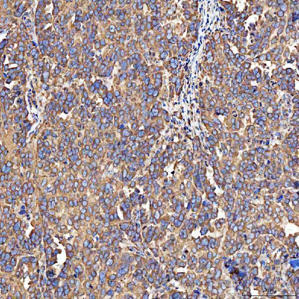 a09094 2 sh2d4a primary antibodies ihc testing 6