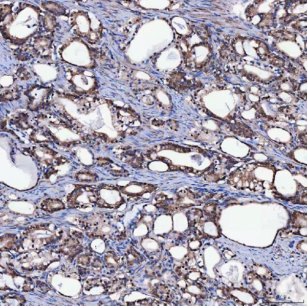 a09094 2 sh2d4a primary antibodies ihc testing 8