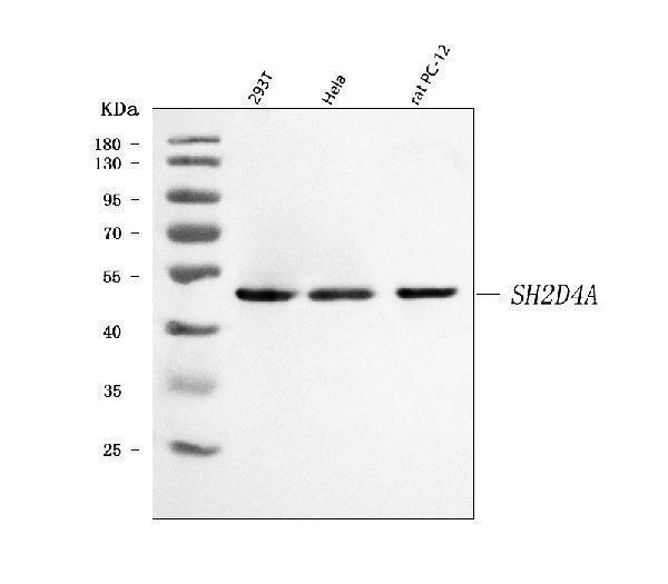  Western blot analysis of SH2D4A using anti-SH2D4A antibody (A09094-2)