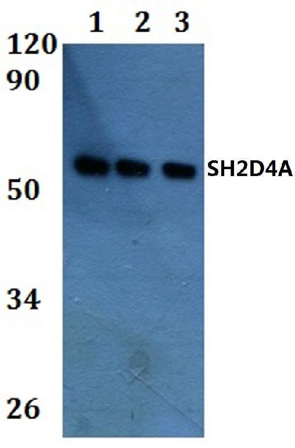 a09094 sh2d4a primary antiboties wb testing 1