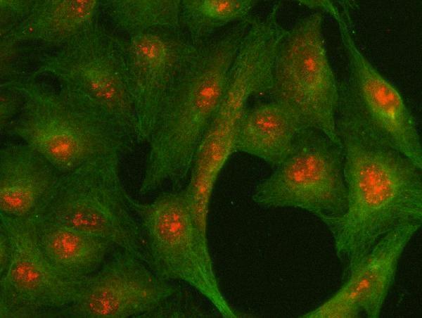  IF analysis of Centromere protein R/ITGB3BP using anti-Centromere protein R/ITGB3BP antibody (A09098-1) and anti-Beta Tubulin antibody (M01857-3)