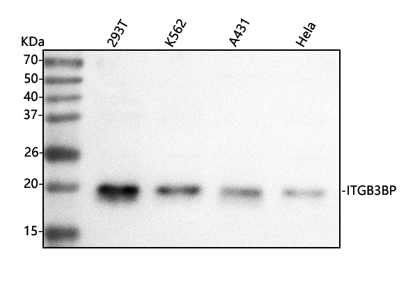  Western blot analysis of Centromere protein R/ITGB3BP using anti-Centromere protein R/ITGB3BP antibody (A09098-1)