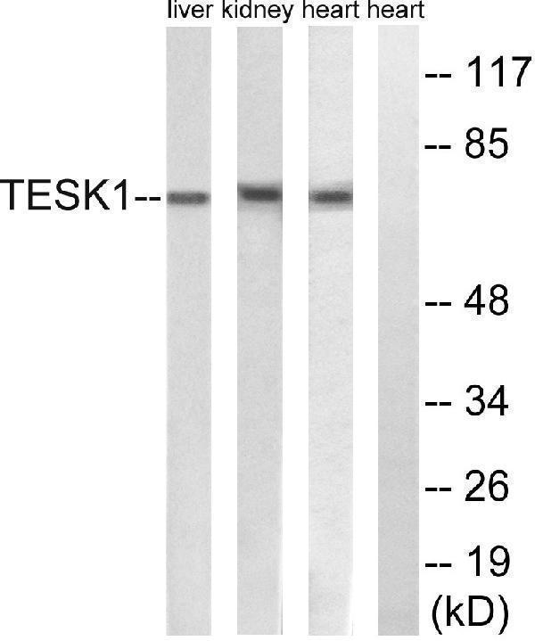 Western blot analysis of lysates from rat heart, rat kidney, and rat liver cells, using TESK1 Antibody
