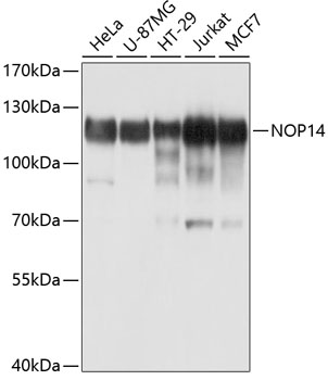 Western blot analysis of extracts of various cell lines, using NOP14 antibody  at 1:1000 dilution