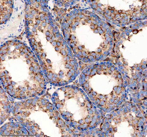 IHC analysis of ZDHHC13 using anti-ZDHHC13 antibody (A09102-1)