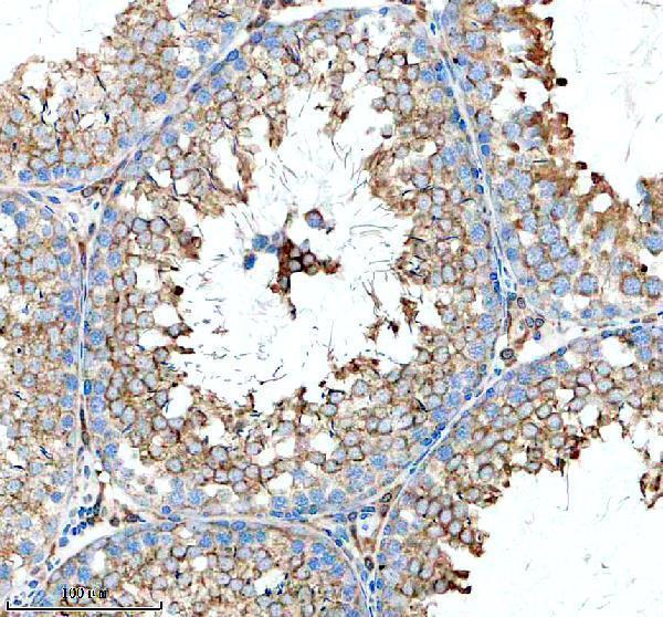 IHC analysis of ZDHHC13 using anti-ZDHHC13 antibody (A09102-1)