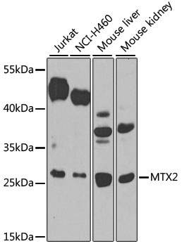 a09105 mtx2 primary antiboties wb testing 1
