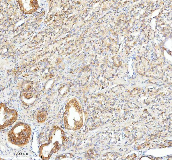  IHC analysis of SLC25A25 using anti-SLC25A25 antibody (A09109-1)