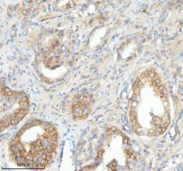 IHC analysis of SLC25A25 using anti-SLC25A25 antibody (A09109-1)
