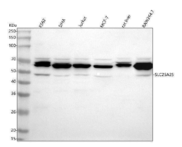  Western blot analysis of SLC25A25 using anti-SLC25A25 antibody (A09109-1)