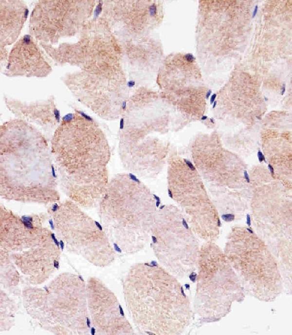 Immunohistochemical analysis of paraffin-embedded H