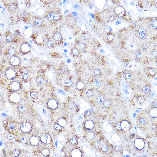 a09111 aadat primary antiboties ihc testing 2