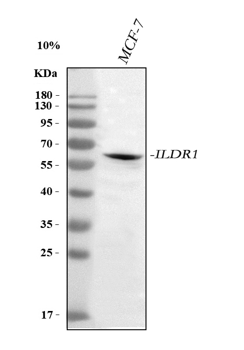 a09114 1 ildr1 primary antibodies wb testing 1