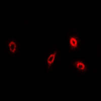 Immunofluorescent analysis of sPLA2-IID staining in U2OS cells
