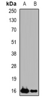 Western blot analysis of sPLA2-IID expression in Hela (A), THP1 (B) whole cell lysates