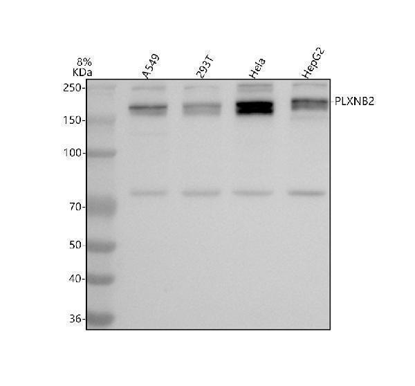  Western blot analysis of PLXNB2 using anti-PLXNB2 antibody (A09119)