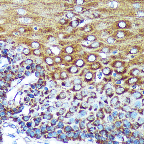 Immunohistochemistry of paraffin-embedded Human esophageal using SPECC1L Rabbit pAb  at dilution of 1:100 