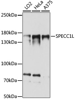 Western blot analysis of extracts of various cell lines, using SPECC1L antibody  at 1:1000 dilution
