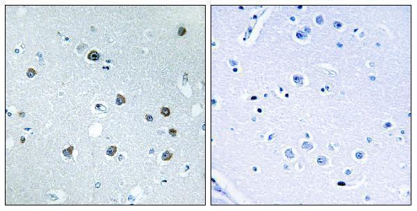 a09126 1 myo1d primary antibodies ihc testing 1