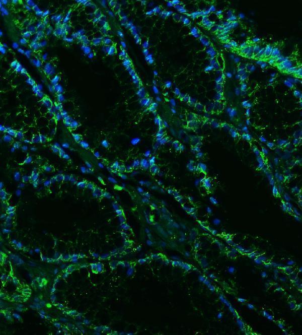 a09129 1 cldn18 primary antibodies if testing 6