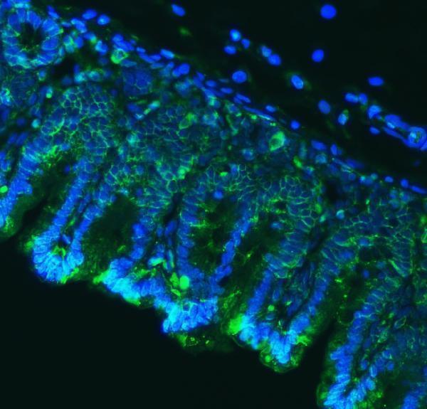 a09129 1 cldn18 primary antibodies if testing 7