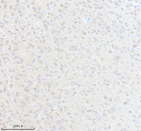 IHC analysis of HS3ST1 using anti-HS3ST1 antibody (A09131-3)