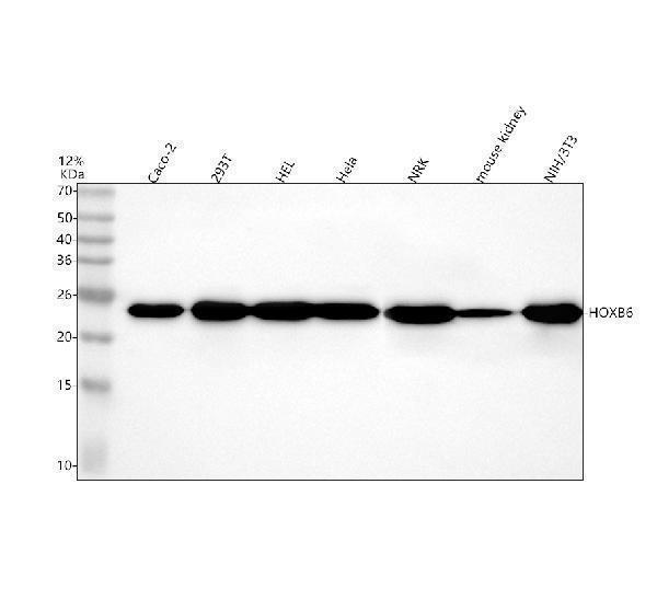 a09133 2 hoxb6 primary antibodies wb testing 1
