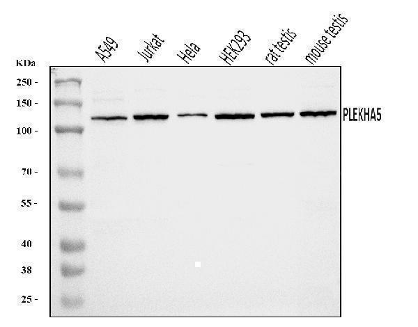  Western blot analysis of PEPP2/PLEKHA5 using anti-PEPP2/PLEKHA5 antibody (A09135-2)