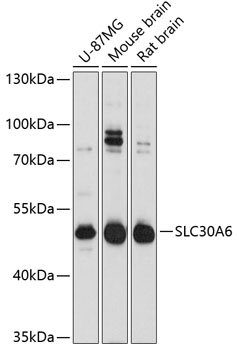 a09137 slc30a6 primary antiboties wb testing 1