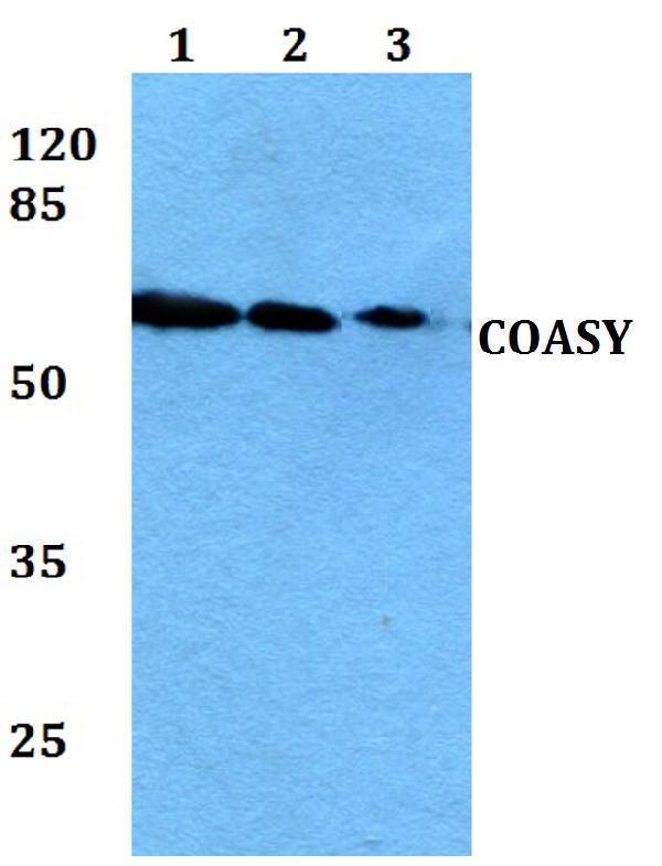 Western blot (WB) analysis of COASY polyclonal antibody at 1:500 dilution
Lane1:HEK293T whole cell lysate
Lane2:Raw264